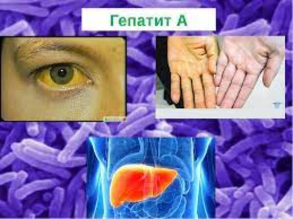 Қазақстанда гепатит А ауруына шалдыққандар көбейген