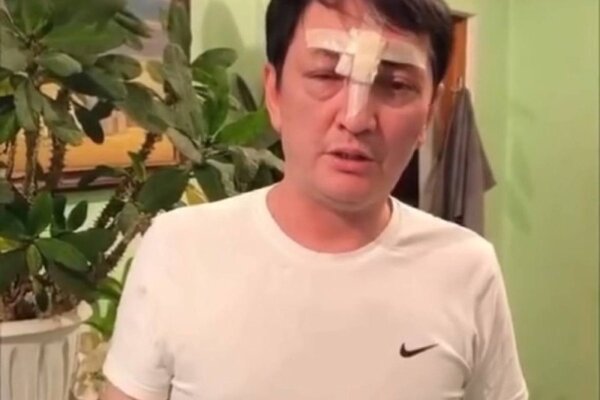 Теріс ағымдағылар "академикті" соққыға жықты