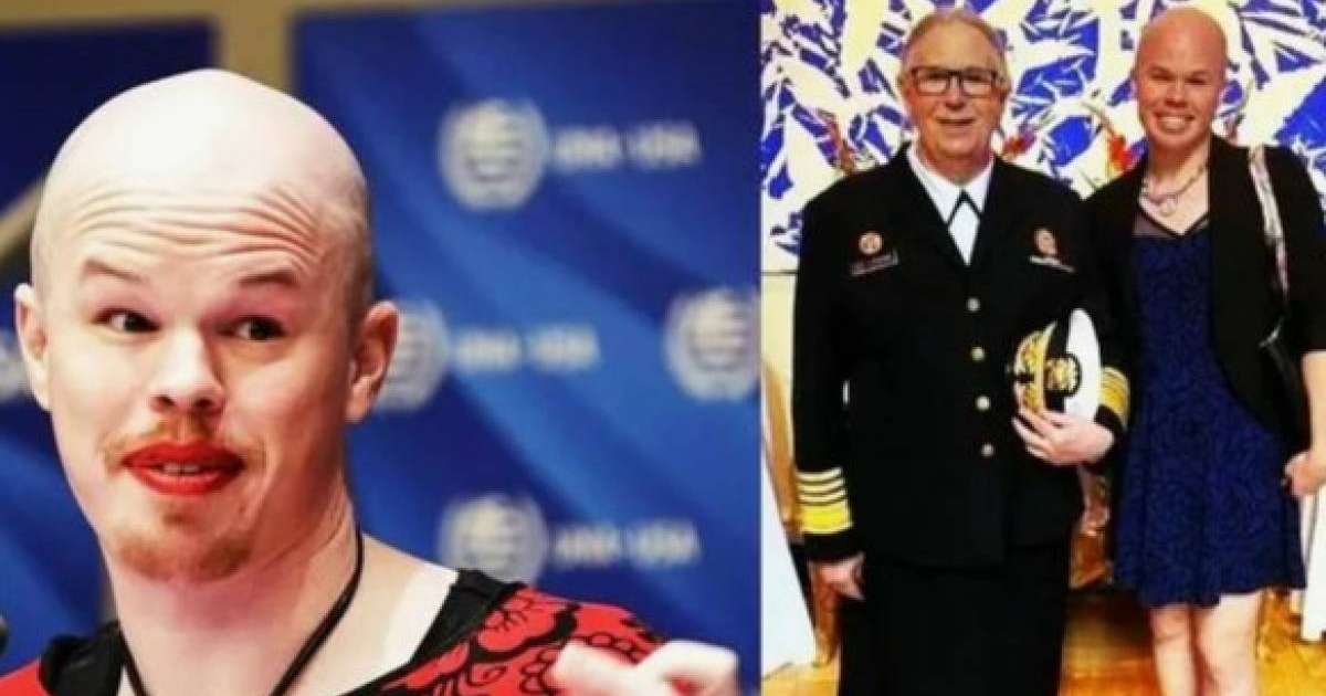 Олар бұлтты сұйықтықпен аяқталады