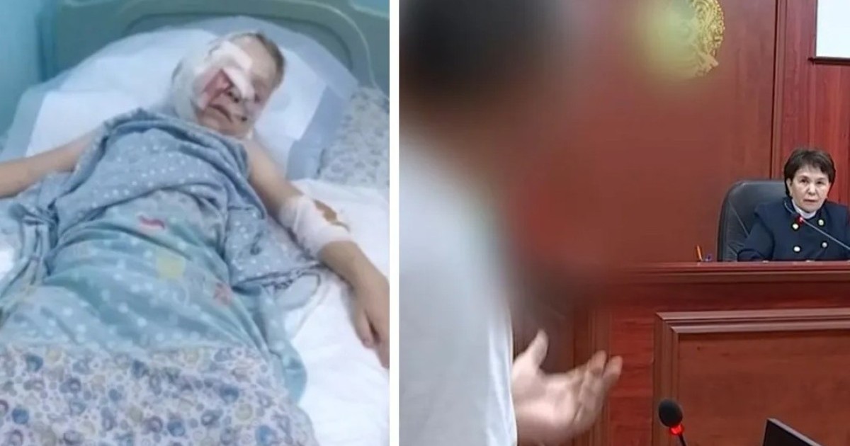 11 жасар балаға бірнеше ит шабуыл жасаған: Жануарлардың иесі сотталып жатыр