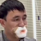 Қызбен сүйісемін деп тілінен айрылып қалған жігіт туралы тың мәлімет тарады