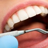 Тағы бір бала тіс емханасында көз жұмды