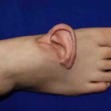 Қытайлық дәрігерлер науқастың құлағын оның аяғына тігіп, өмірін сақтап қалды