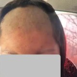 Кәмелетке толмаған қызды ұрып-соғып, шашын қырып тастаған (ФОТО)