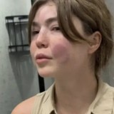 Алматыда соққыға жығылған әйел күйеуімен ажыраса алмай отыр