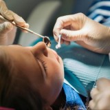 Бойжеткен қыз ақыл тісін жұлдыртқаннан кейін бірден комаға түсіп, көз жұмды (ФОТО)