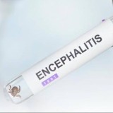 Қазақстанда 478 адамды кене шақты: дәрігерлер ескерту жасады