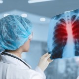 Астанадағы медицина қызметкерінен туберкулез анықталды