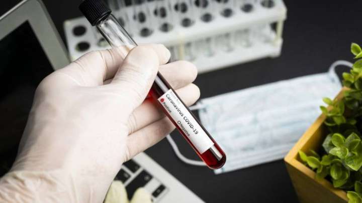 ПЦР мен КТ-дан өтуге неге асықпау керек?