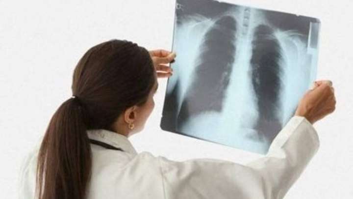 Белгісіз пневмония COVID-19-дан да қауіпті ме?