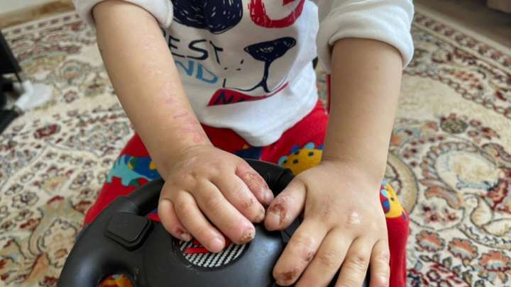 Ананың мұңы: Тісін жұлып, тілін шайнап, тырнақтарын жеп қояды