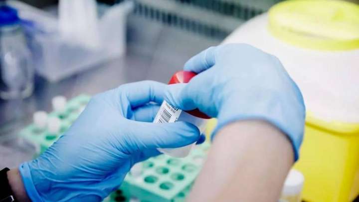 Маймыл шешегі пандемия деп танылды