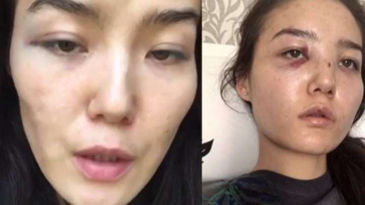 Қазақстанның БАӘ елшісінің кеңесшісі әйелін ұрып-соққан