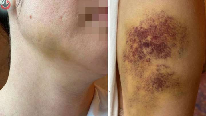 Павлодар облысында кәсіпорын директоры әйелін бірнеше жыл бойы ұрып-соққан