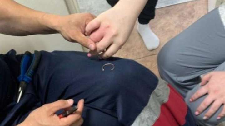 Сақинасын шеше алмай, құтқарушыларды шақырған