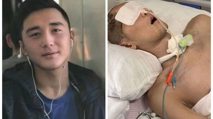 Ербаян Мұхтар Түркияға емделуге жіберілді