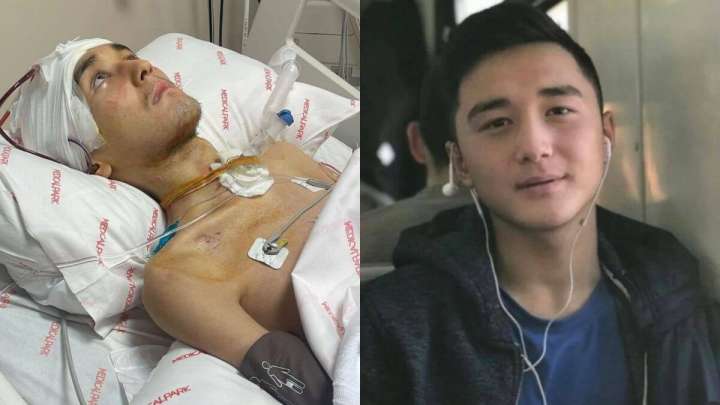 Әскерде мүгедек болып қалған Ербаянға Түркияда ота жасалды