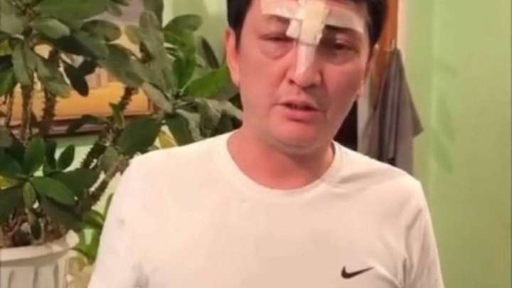 Теріс ағымдағылар "академикті" соққыға жықты