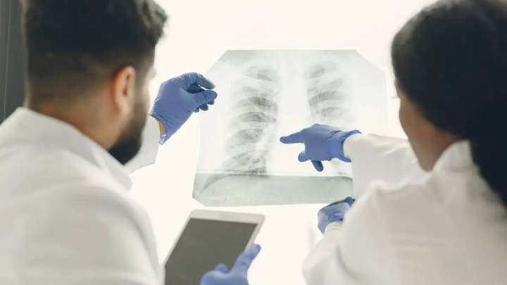 Елімізде 76 мыңнан астам адам пневмонияға шалдыққан