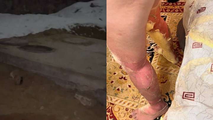 Ақтауда құдыққа құлаған оқушы жансақтау бөлімінде жатыр