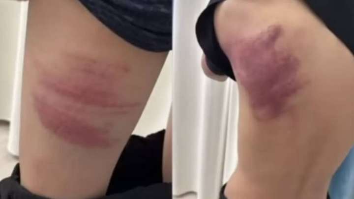 Атырау облысында оқушылар екі жасөспірімді қатыгездікпен ұрып-соққан