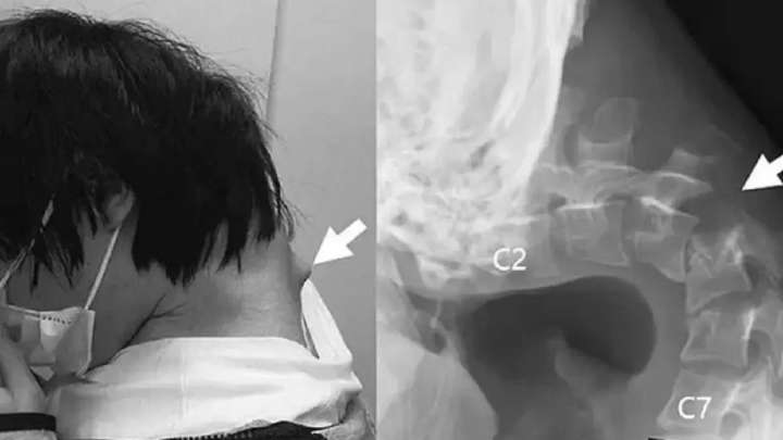 Смартфонға тәуелді жігіттің басы "салбырап" қалған