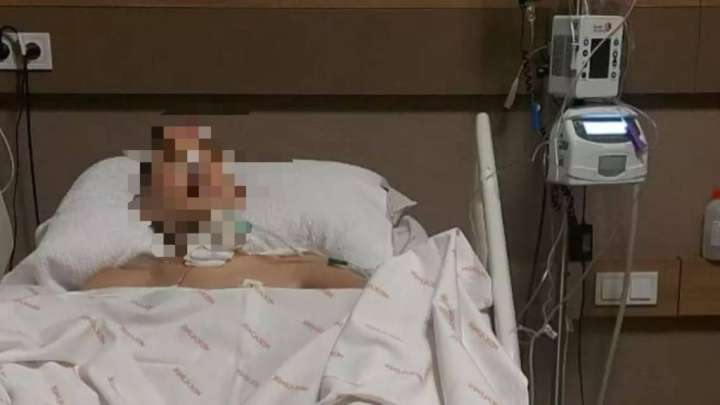 Өскеменде 3 жасар бала алтыншы қабаттан құлап кетті