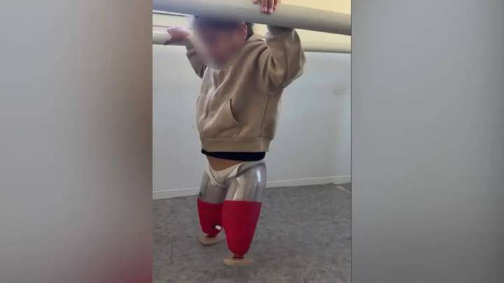 Автобус апатынан екі аяғынан айырылған қыз протезбен жүруді үйрене бастады