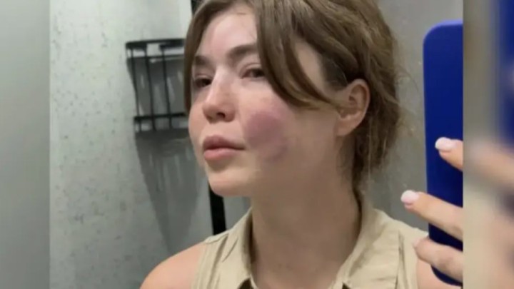 Алматыда соққыға жығылған әйел күйеуімен ажыраса алмай отыр