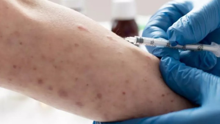 Екі мыңға жуық адам: Денсаулық сақтау министрлігі қызылшаға байланысты дабыл қақты