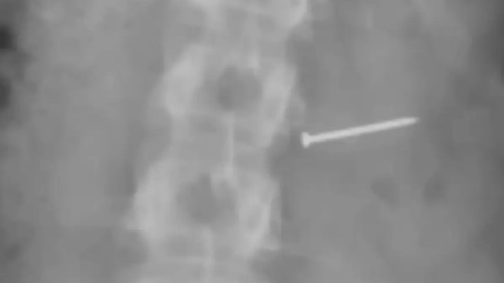 Балмұздақтың ішінен шеге шықты: Әйел адам тосын жағдайға тап болып, артынша миллионер атанды (ФОТО)