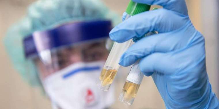 Қазақстанда коронавируспен ауыратындар саны 35-ке жетті