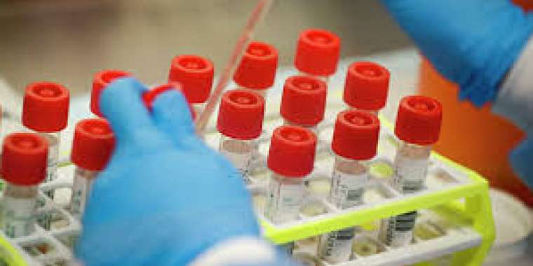 Бір түнде коронавирус індетін жұқтырған 41 адам анықталды