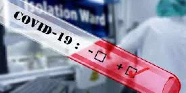 Ғалымдар коронавирусты анықтайтын тестті жетілдіріп жатыр
