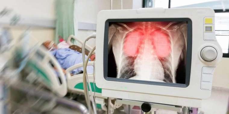 Коронавирустан қайтыс болғандар 60-тан асты