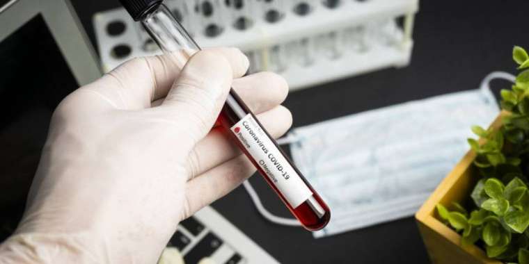 ПЦР мен КТ-дан өтуге неге асықпау керек?