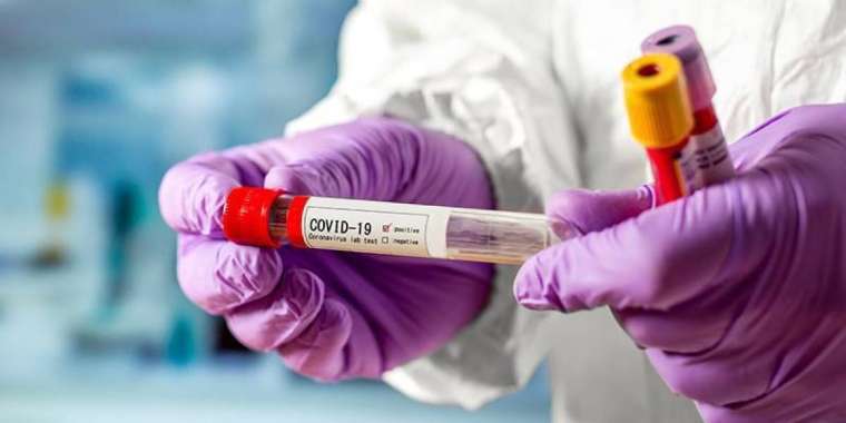 Біріккен статистика: Бір тәулікте 6407 адам ауырған