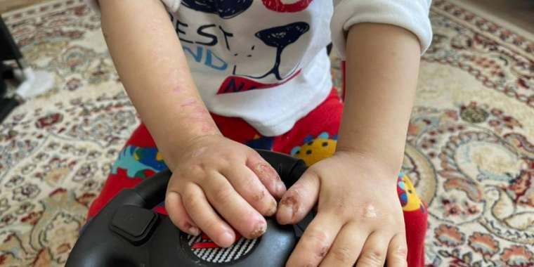 Ананың мұңы: Тісін жұлып, тілін шайнап, тырнақтарын жеп қояды