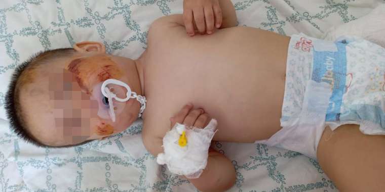 Балабақшадан – ауруханаға: «Директор ақша беріп құтылмақ болды»