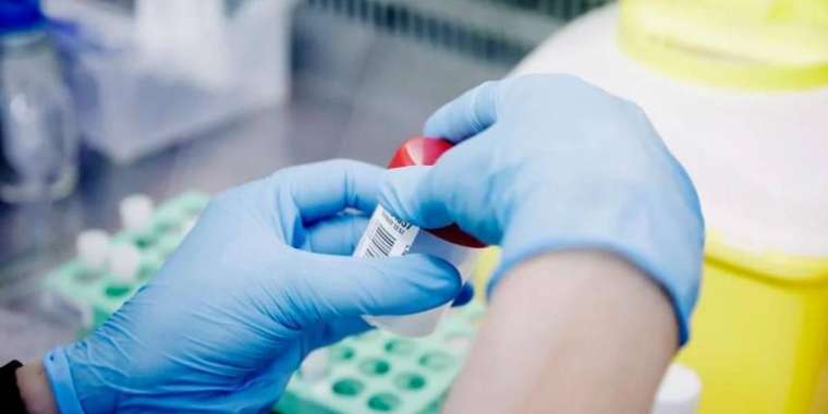 Маймыл шешегі пандемия деп танылды