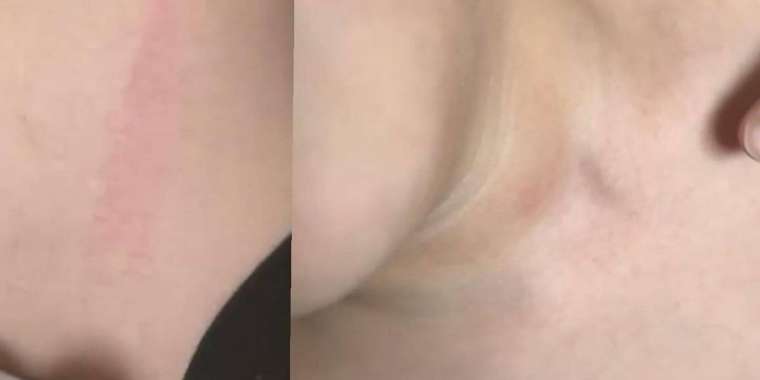  Алматыдағы мектептердің бірінде 6 жастағы баланы сыныптасының әкесі ұрып-соққан