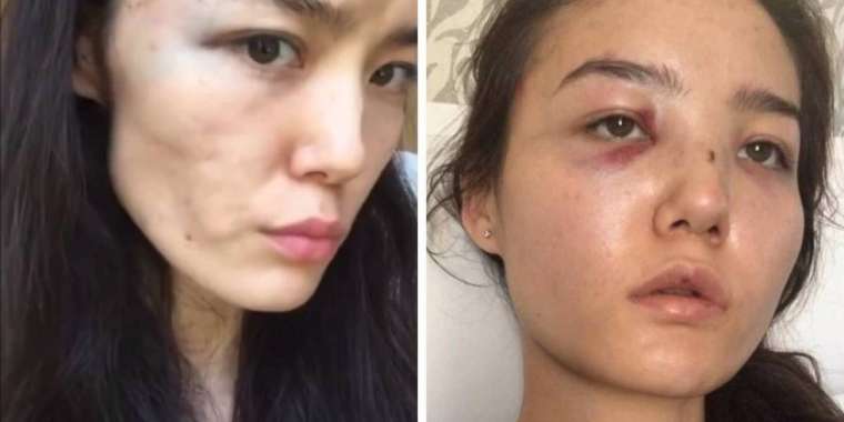 БАӘ-де дипломат күйеуінен зәбір көрген әйел Қазақстанға оралды