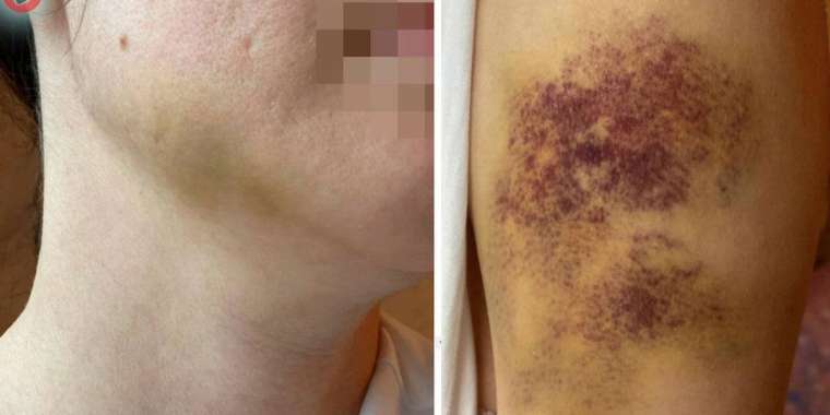 Павлодар облысында кәсіпорын директоры әйелін бірнеше жыл бойы ұрып-соққан