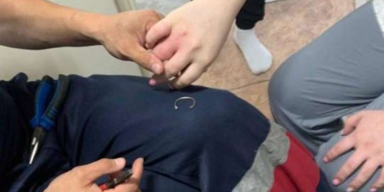 Сақинасын шеше алмай, құтқарушыларды шақырған