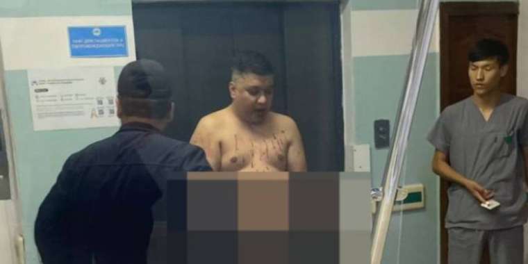 Үсті-басы қанға боялған әнші Алтынбек Тәшімбетов қамауға алынуы мүмкін