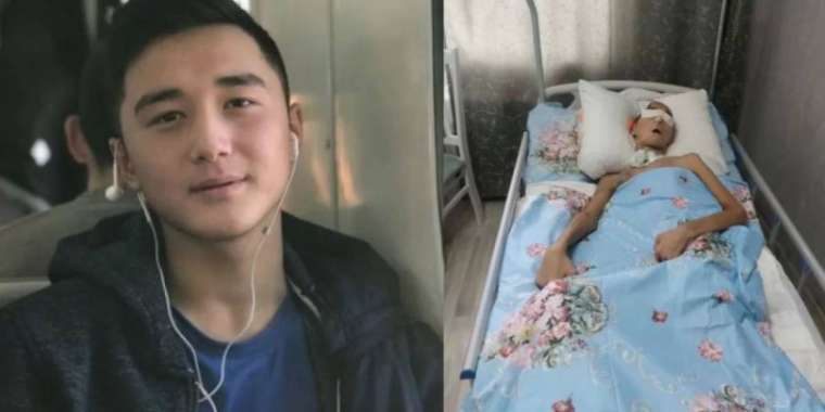 «Жағдайы ауыр»: Министр әскерден мүгедек болып оралған сарбазға қатысты пікір білдірді