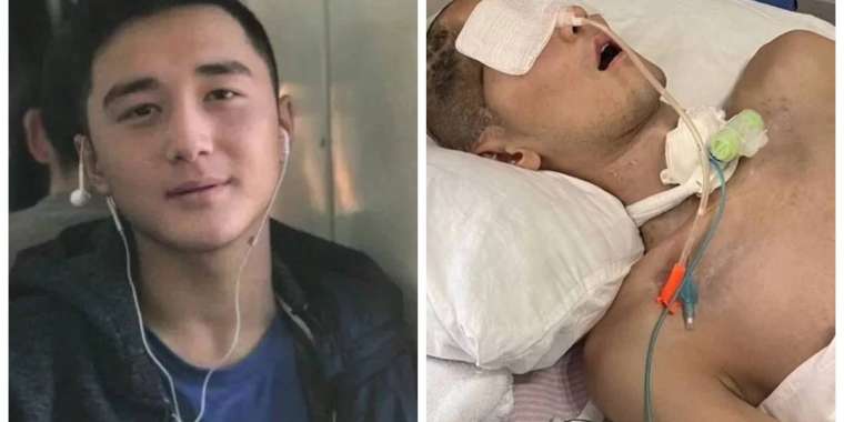 Ербаян Мұхтар Түркияға емделуге жіберілді