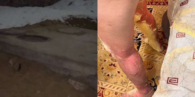 Ақтауда құдыққа құлаған оқушы жансақтау бөлімінде жатыр