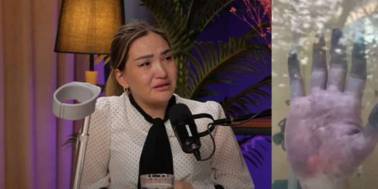 Кептірілген балық жеп, аяқ-қолымнан айырылдым - Бота Бурханова