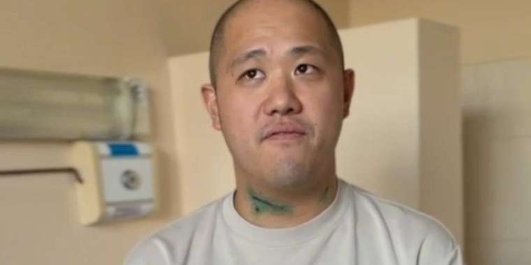 Алматыда дәрігерлер ауыр жарақат алған малайзиялықты аман алып қалды